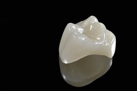 Trustworthy porcelain crowns hudson  Once the bone has grown around the body and it’s strong enough, the oral surgeon positions a permanent crown on top